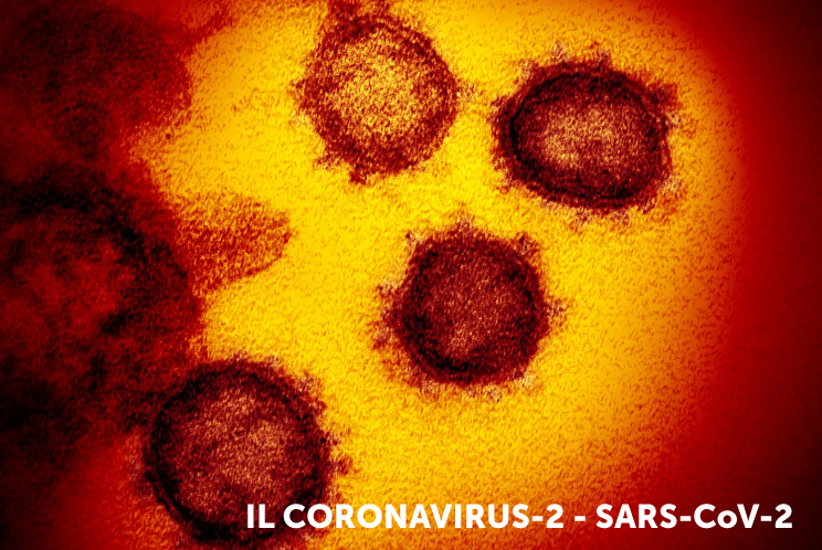 Fig. 1 - La sindrome respiratoria acuta grave Coronavirus-2 (SARS-CoV-2) è il nome dato al nuovo coronavirus del 2019. COVID-19 è il nome dato alla malattia associata al virus.
SARS-CoV-2 è un nuovo ceppo di coronavirus che non è stato precedentemente identificato nell'uomo. Nell'immagine il coronavirus visto al microscopio elettronico - Crediti: Zumapress.com / Agf e Ministero della saluta www.salute.gov.it