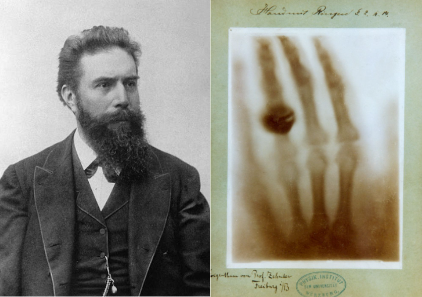 Fig. 1 - Wilhelm Conrad Röntgen (1845-1923) e, a destra, la prima radiografia del mondo: la mano di sua moglie con un vistoso anello al dito. Questa radiografia è stata ottenuta nel Novembre 1895, pochi giorni dopo la scoperta dei raggi X - Crediti: web.